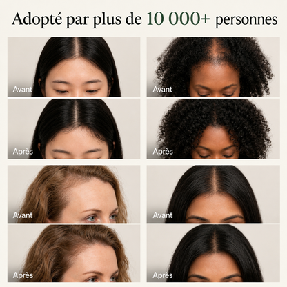 Orivéa™