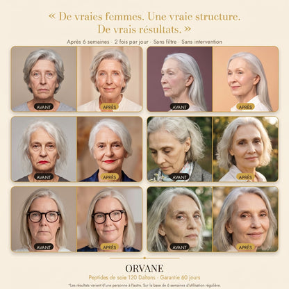 Avant / Après 6 semaines