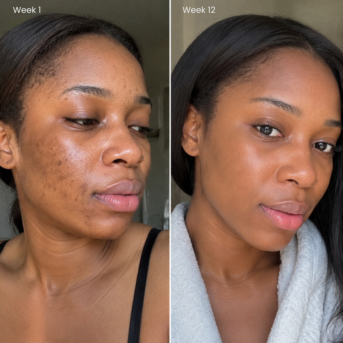 Puryvea 7% Arbutin + 4% Tranexamic Acid — dark spot facial treatment
